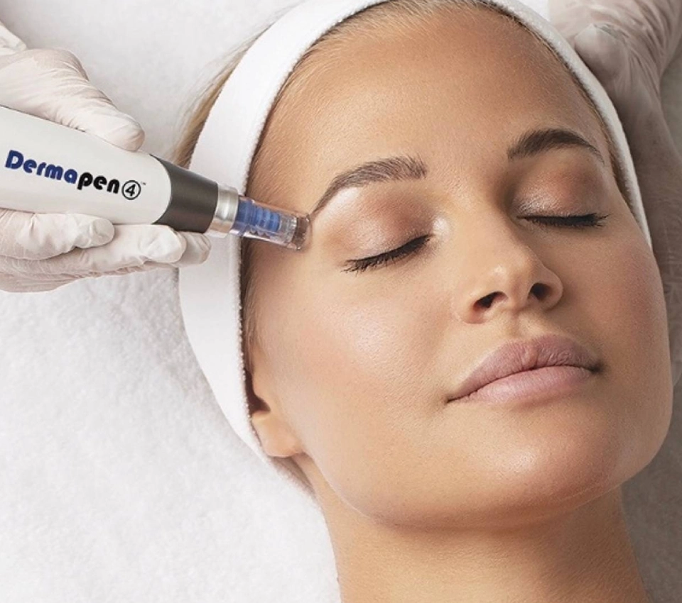 Laser Hair Removal in East Ham