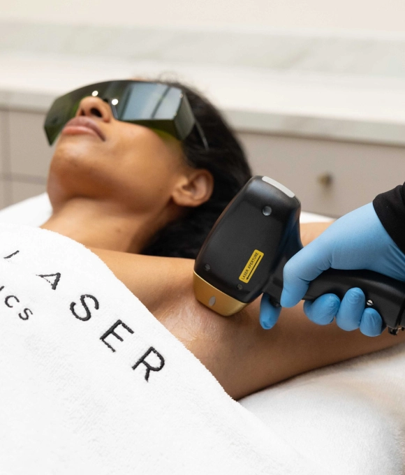 Laser hair removal in East Ham