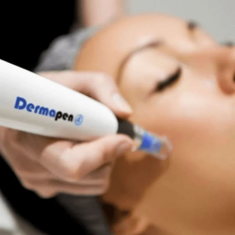 derma-pen