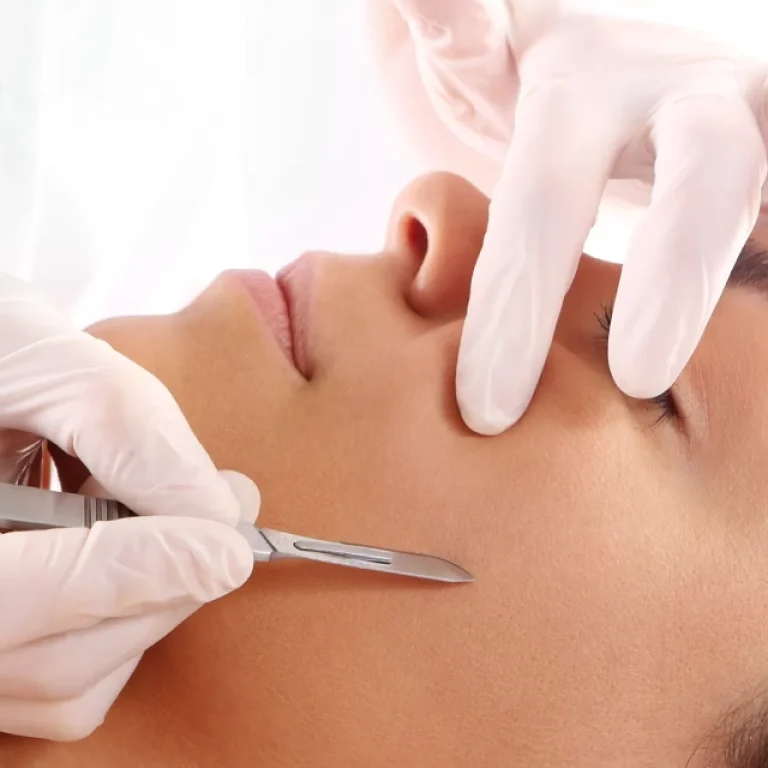 dermaplaning-treatment