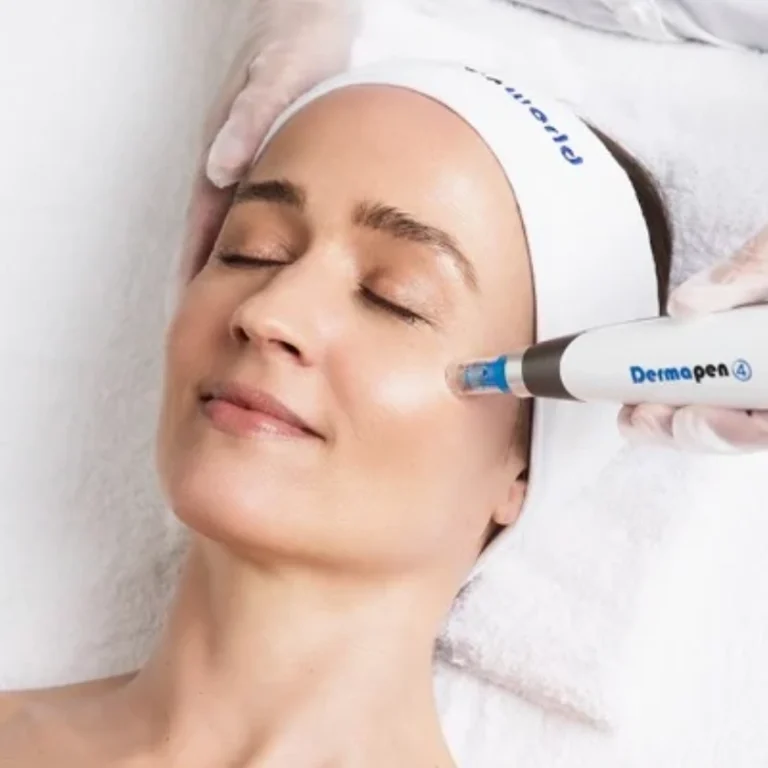 Laser Hair Removal in East Ham
